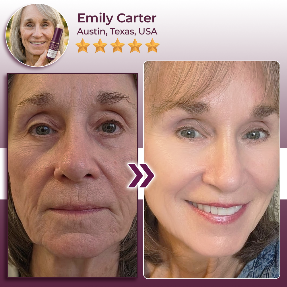 Hudros® Calcium Volume Botox Balm