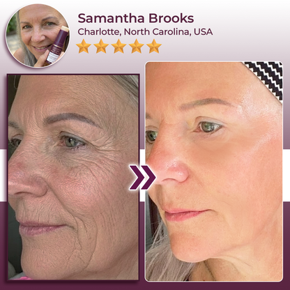Hudros® Calcium Volume Botox Balm