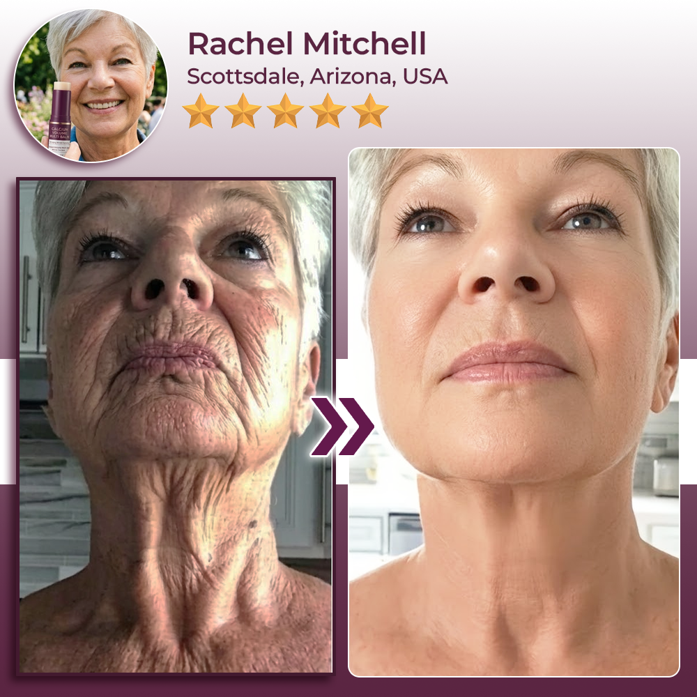 Hudros® Calcium Volume Botox Balm