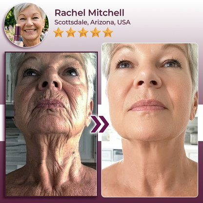 Hudros® Calcium Volume Botox Balm